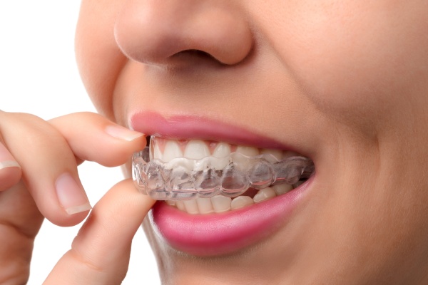 Tips For Getting The Most Out Of Invisalign