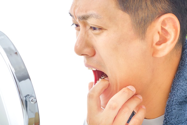 How A Dentist Can Repair A Broken Tooth And Restore Your Smile