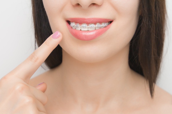 Clear Braces, Aligners, And Other Discreet Orthodontic Treatments