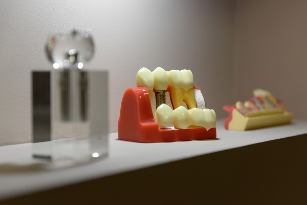 How Many Teeth Can Dental Bridges Replace?