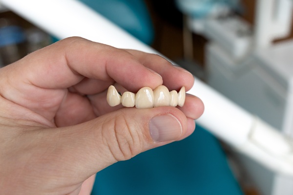 How To Tell If You Are A Candidate For A Dental Bridge