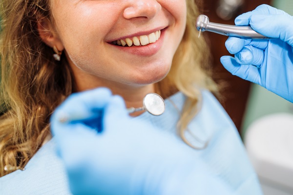 When Should You Get Dental Fillings?
