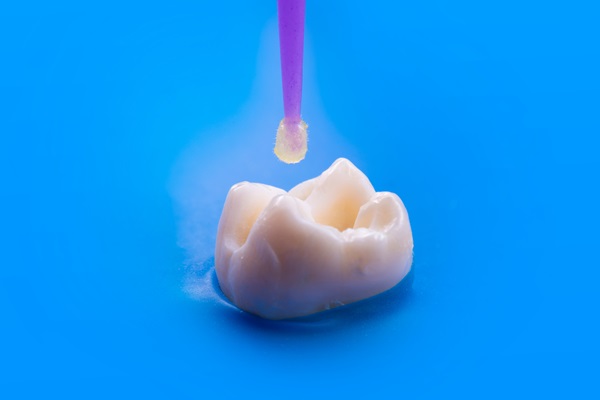 Dental Sealants To Reduce Risk Of Tooth Decay