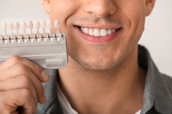 How To Protect The Longevity Of Your New Dental Veneers
