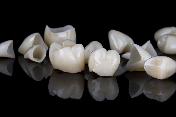 What Are the Differences Between a Dental Crown and a Dental Veneer? from Ohio Cosmetic Dentists in Columbus, OH