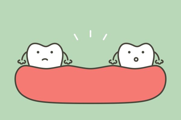 When Is A Dental Bridge Recommended To Replace A Missing Tooth?