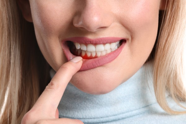 Gum Lift Surgery: Reshaping A Receding Gumline