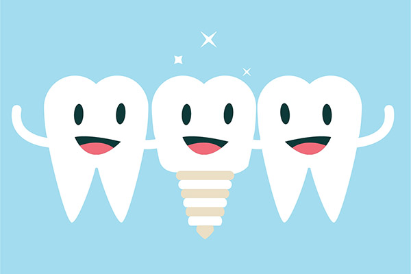 Implant Dentistry Aftercare FAQs from Ohio Cosmetic Dentists in Columbus, OH
