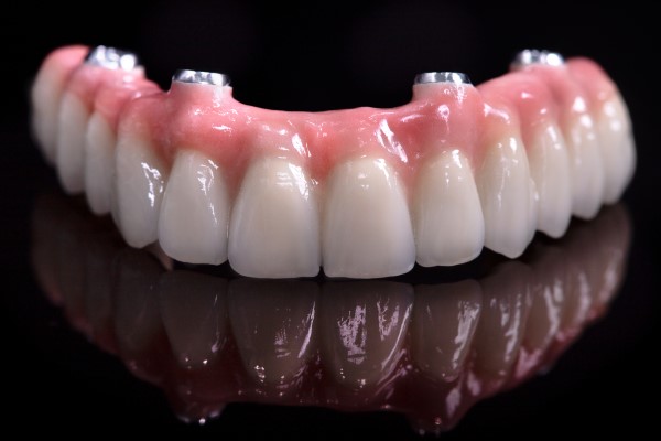 How Implant Supported Dentures Can Improve Your Smile