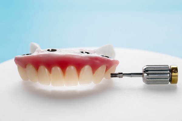 How Common Are Implant Supported Dentures?