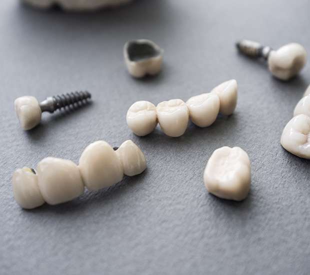Columbus The Difference Between Dental Implants and Mini Dental Implants