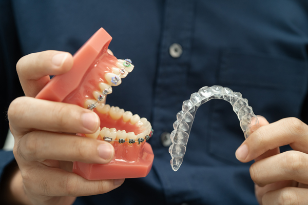 When To Schedule A Consultation With An Invisalign Dentist
