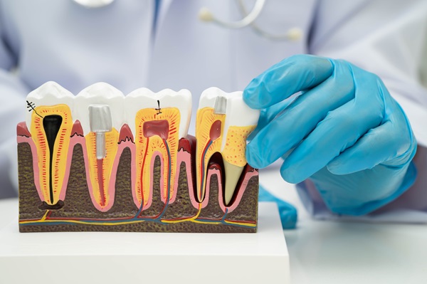 Root Canal Treatment: What To Expect And How It Saves Your Smile