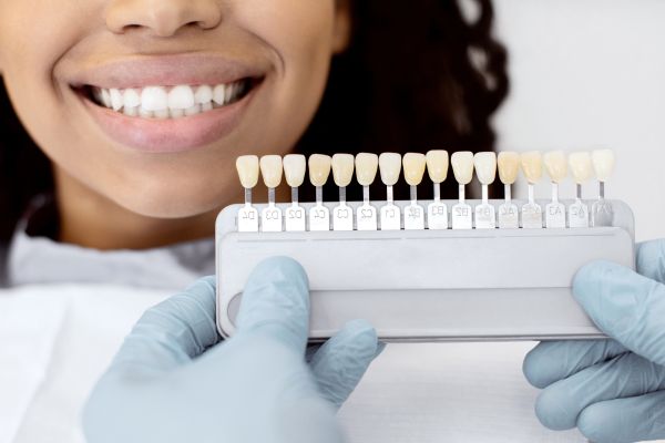 Comparing Professional And Over The Counter Teeth Bleaching