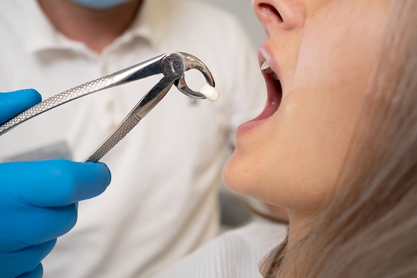 When A Dental Emergency May Require Tooth Extractions